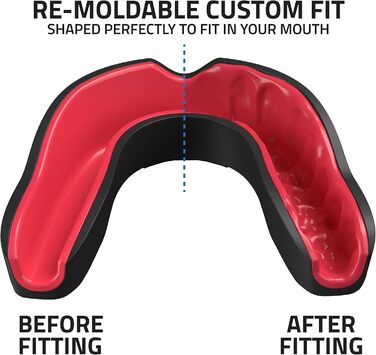 Захисна капа Titanium Sports Premium - Slim Fit з чохлом. Капу для захисту щелепи під час контактних видів спорту (бокс, ММА, джудо, карате, регбі, хокей, футбол). Червоний/Чорний. Для дітей (<11)